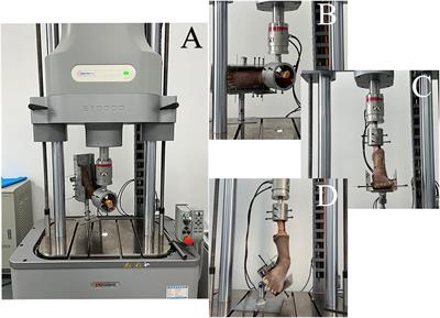 Chronic lateral ankle instability using anterior tibiofibular ligament distal fascicle transfer augmentation repair: an anatomical, biomechanical, and histological study